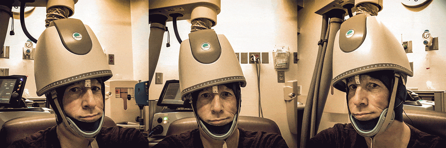 If I Had A Hammer: Transcranial Magnetic Stimulation 2